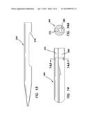 SYSTEMS AND METHODS FOR CREATING ARTERIOVENOUS (AV) FISTULAS diagram and image