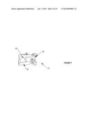 Transpedicular Disk Access System diagram and image