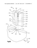 Surgical Guide with Cut Resistant Inserts diagram and image