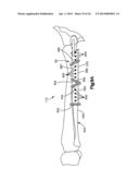 Surgical Guide with Cut Resistant Inserts diagram and image