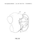 PATIENT-MATCHED INSTRUMENTS diagram and image