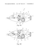 Plication Lock Delivery System and Method of Use Thereof diagram and image