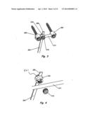 Device and Method for Treatment of Spinal Deformity diagram and image