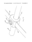 Device and Method for Treatment of Spinal Deformity diagram and image