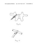 Device and Method for Treatment of Spinal Deformity diagram and image