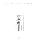 Spinal Stabilization Device diagram and image