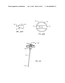 Spinal Stabilization Device diagram and image