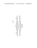 Spinal Stabilization Device diagram and image