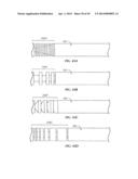 Spinal Stabilization Device diagram and image