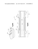 Spinal Stabilization Device diagram and image