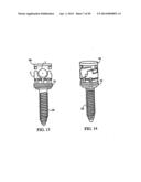 Polyaxial Screw diagram and image