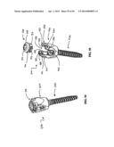 Polyaxial Screw diagram and image