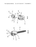 Polyaxial Screw diagram and image