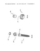 Polyaxial Screw diagram and image