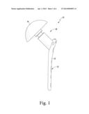 ADJUSTABLE HEIGHT ARTHROPLASTY PLATE diagram and image