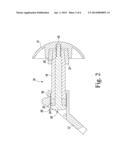 ADJUSTABLE HEIGHT ARTHROPLASTY PLATE diagram and image