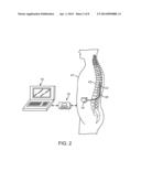 METHOD FOR TREATING DEPRESSION BY INDIRECTLY STIMULATING RAPHE NUCLEI diagram and image