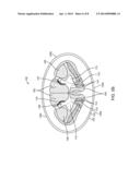 METHOD FOR TREATING DEPRESSION BY INDIRECTLY STIMULATING RAPHE NUCLEI diagram and image