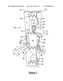 VASCULAR ENDOGRAFT diagram and image