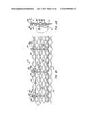 Retrievable Heart Valve Anchor and Method diagram and image