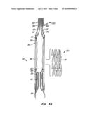 Retrievable Heart Valve Anchor and Method diagram and image