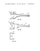 Retrievable Heart Valve Anchor and Method diagram and image