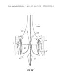 Retrievable Heart Valve Anchor and Method diagram and image