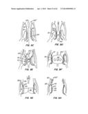 Retrievable Heart Valve Anchor and Method diagram and image