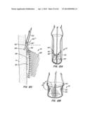 Retrievable Heart Valve Anchor and Method diagram and image