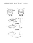 Retrievable Heart Valve Anchor and Method diagram and image