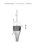 Retrievable Heart Valve Anchor and Method diagram and image