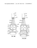 Retrievable Heart Valve Anchor and Method diagram and image