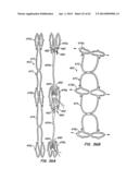 Retrievable Heart Valve Anchor and Method diagram and image