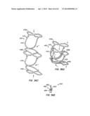 Retrievable Heart Valve Anchor and Method diagram and image