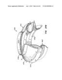 Retrievable Heart Valve Anchor and Method diagram and image