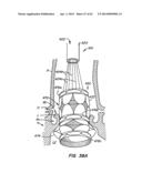 Retrievable Heart Valve Anchor and Method diagram and image