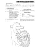 TISSUE ANCHORS, SYSTEMS AND METHODS, AND DEVICES diagram and image