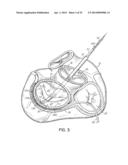 TISSUE ANCHORS, SYSTEMS AND METHODS, AND DEVICES diagram and image