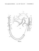 TISSUE ANCHORS, SYSTEMS AND METHODS, AND DEVICES diagram and image