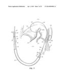 TISSUE ANCHORS, SYSTEMS AND METHODS, AND DEVICES diagram and image