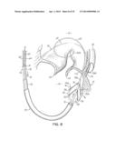 TISSUE ANCHORS, SYSTEMS AND METHODS, AND DEVICES diagram and image