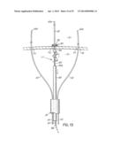 TISSUE ANCHORS, SYSTEMS AND METHODS, AND DEVICES diagram and image