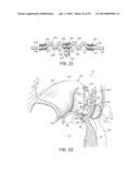 TISSUE ANCHORS, SYSTEMS AND METHODS, AND DEVICES diagram and image