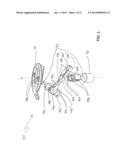 Variable-length passive ossicular prosthesis diagram and image