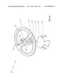 Variable-length passive ossicular prosthesis diagram and image