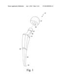 ORTHOPAEDIC HIP PROSTHESIS HAVING FEMORAL STEM COMPONENTS WITH VARYING A/P     TAPER ANGLES diagram and image