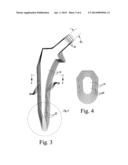 ORTHOPAEDIC HIP PROSTHESIS HAVING FEMORAL STEM COMPONENTS WITH VARYING A/P     TAPER ANGLES diagram and image
