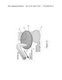 IMAGING DEVICE AND METHOD diagram and image