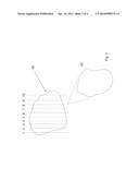 TISSUE SAMPLING FOR PATHOLOGICAL STUDY diagram and image