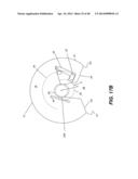 EXTREMITY IMAGING APPARATUS FOR CONE BEAM COMPUTED TOMOGRAPHY diagram and image